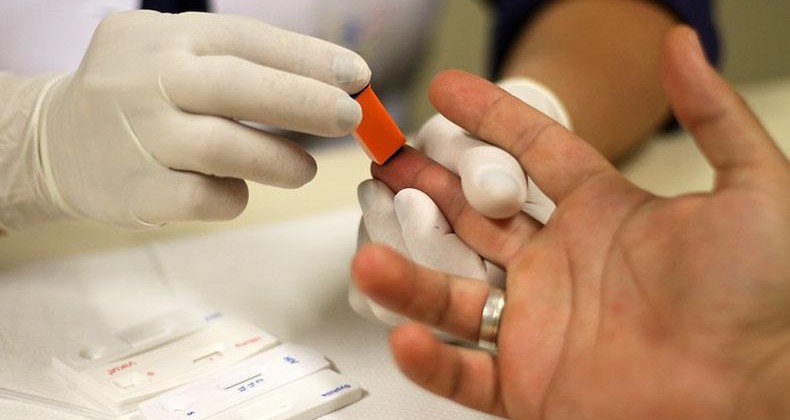 Oms Monitora 169 Casos De Hepatite Aguda Desconhecida Alvorada Fm Sempre Mais Pra Vc 2612